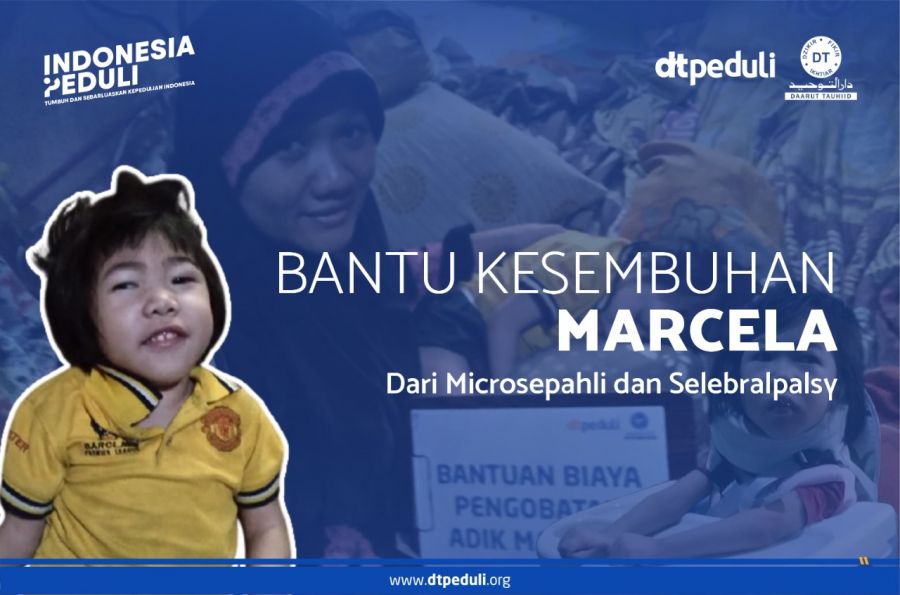 Harapan Sembuh Marcela Bocah 5 Tahun Penderita Penyakit Langkah Microsepahli dan Selebralpalsy 
